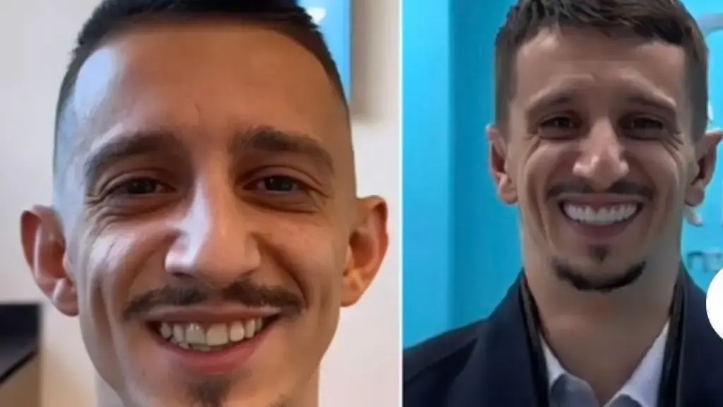 Gani Germia publikon foto pas ndërhyrjeve në fytyrë, nuk do ta njihni